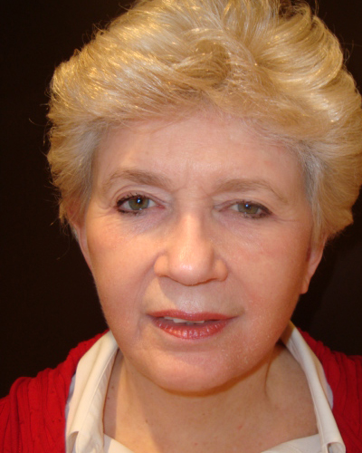 facelift patient